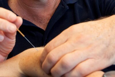 Dry Needling Website 2025